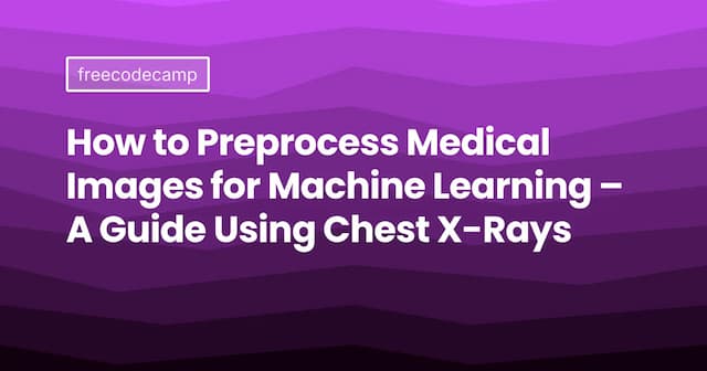 How to Preprocess Medical Images for Machine Learning – A Guide Using Chest X-Rays